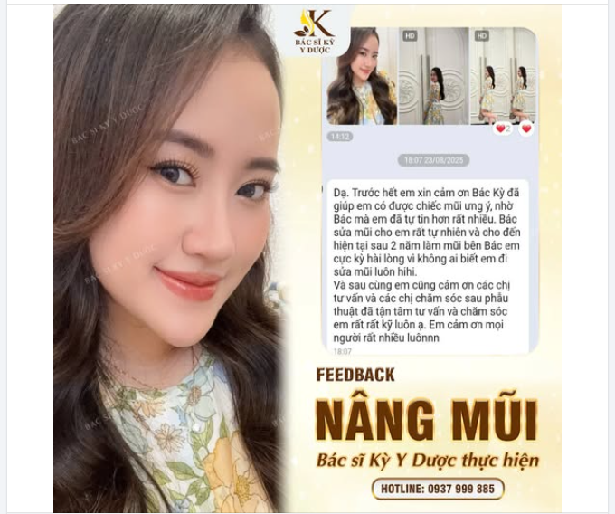 Feedback khách hàng Thủy Tiên (1997) sau khi Nâng Mũi ALINE tại Bác sĩ Kỳ Y Dược