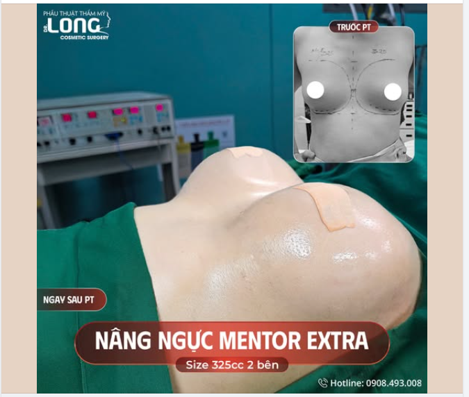 MỀM MẠI TỰ NHIÊN - TÔN NÉT ĐẸP RIÊNG