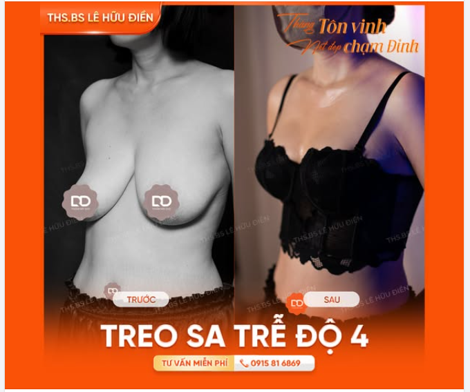 TÁI SINH VÒNG 1 CỦA MẸ BỈM 2 CON