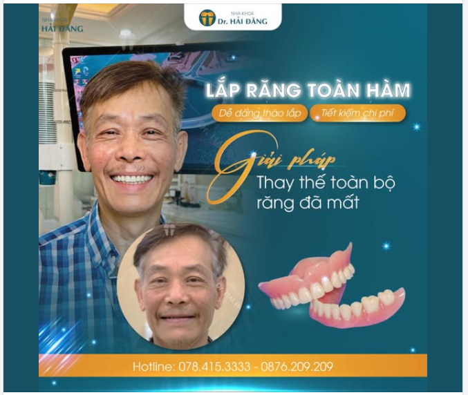 LẮP RĂNG TOÀN HÀM – GIẢI PHÁP TRỌN VẸN CHO NỤ CƯỜI