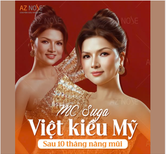 Diện mạo trẻ trung, tươi tắn của MC Suga sau 10 tháng nâng mũi