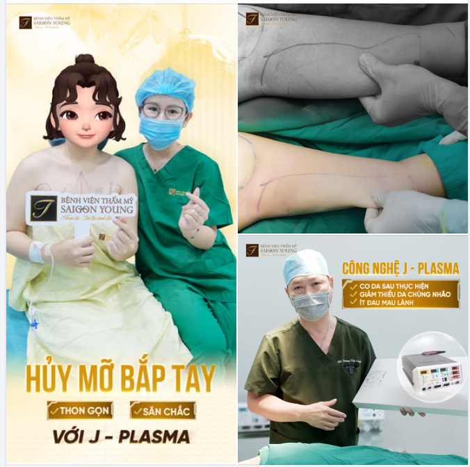 BẮP TAY THON SĂN CHẮC – TẠM BIỆT DA LỎNG LẺO