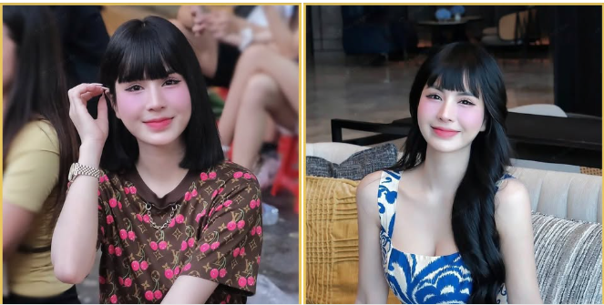 Thời gian chính là thước đo chân thật nhất của vẻ đẹp. Sau 6 năm tạo hình mũi cấu trúc Barbie-line bằng sụn tự thân và thanh surgiform.