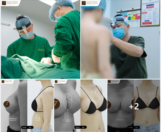 THÔNG KHE, MUỐN HẠ SIZE: SAU 4 NĂM NÂNG VÒNG 1 TẠI NƠI KHÁC