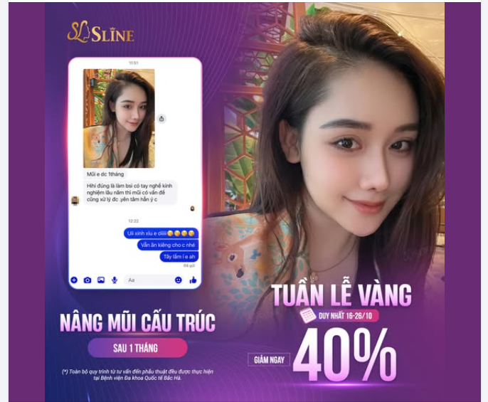 TÔI ĐÃ TỰ TIN HƠN SAU KHI NÂNG MŨI CẤU TRÚC.