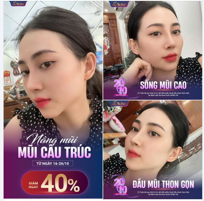 NÂNG MŨI CẤU TRÚC   "Thiết kế dáng mũi chuẩn theo từng khuôn mặt"