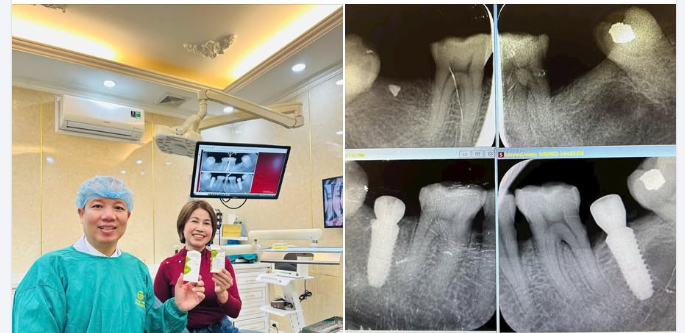 Chị Ngãi – Kiều bào Đức trở về Việt Nam, trao trọn niềm tin cho Nha khoa Hải Đăng