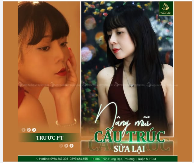 NÂNG MŨI SỬA LẠI – LẤY LẠI VẺ ĐẸP HOÀN HẢO!!
