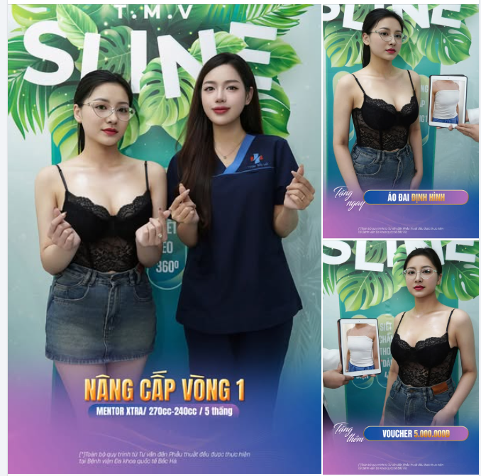 NÂNG CẤP VÒNG 1 – BÍ MẬT CỦA SỰ QUYẾN RŨ.