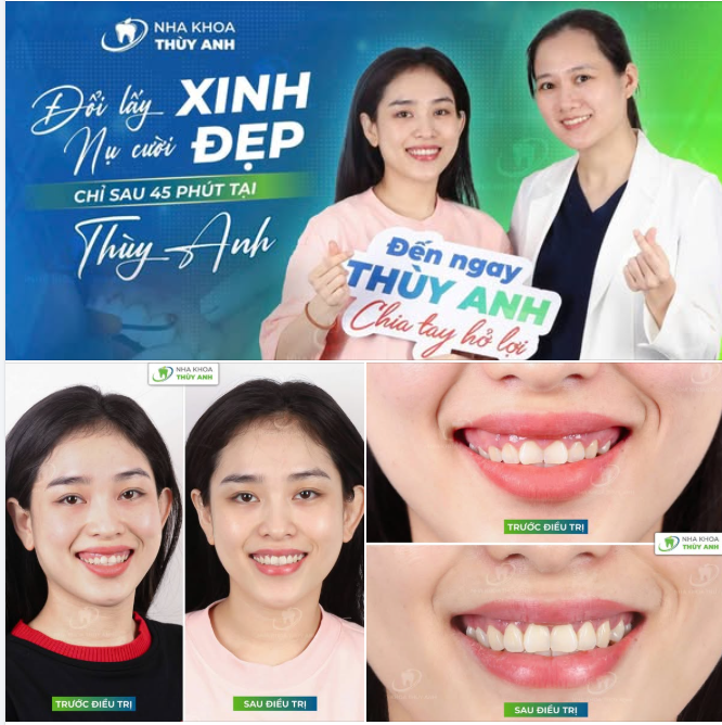 HẾT HỞ LỢI – NỤ CƯỜI NÂNG TẦM NHAN SẮC