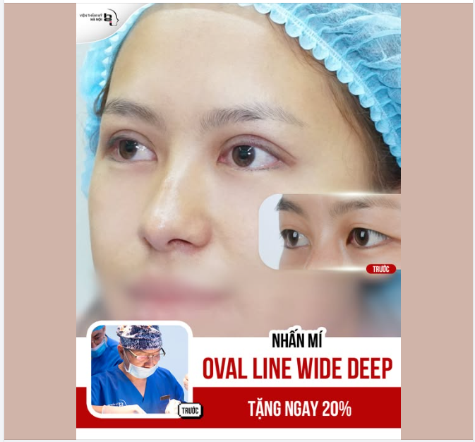 MẮT 2 MÍ TO TRÒN – TƯƠI TẮN CHUẨN TỶ LỆ VÀNG