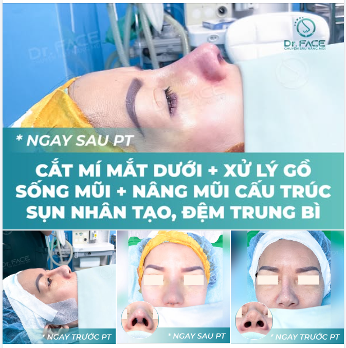 TIN BS CHỈ SAU 2 TIẾNG THEO DÕI