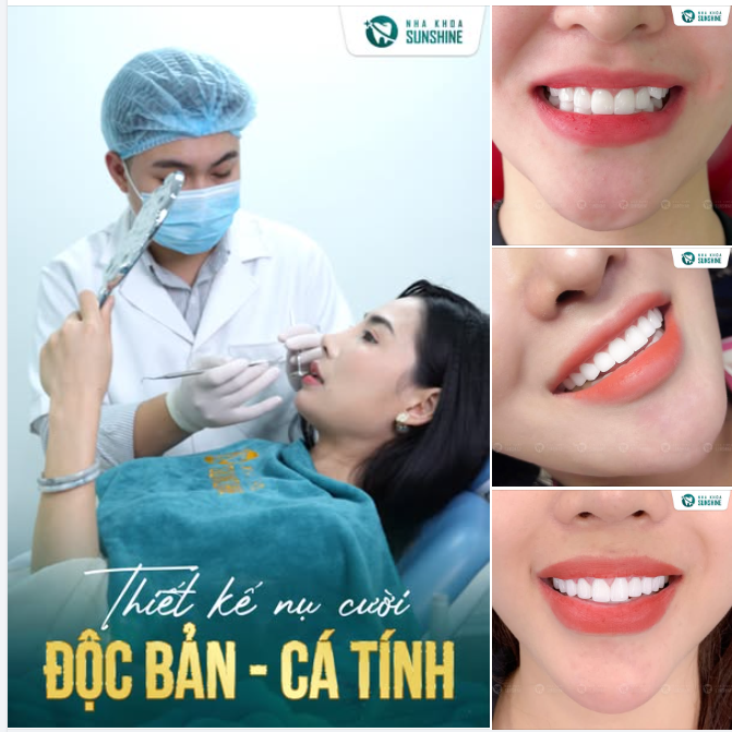 HIẾT KẾ NỤ CƯỚI ĐỘC BẢN - CÁ TÍNH CHO NÀNG!