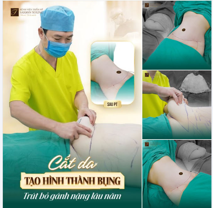 BỎ LẠI PHIỀN TOÁI LÂU NĂM, KHÁCH HÀNG ĐÓN VÒNG EO GỌN GÀNG ĐẦY TỰ TIN