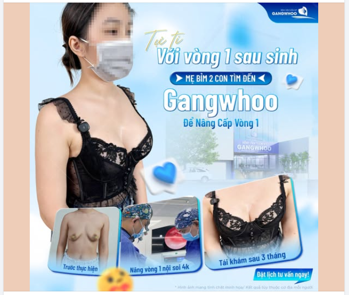 TỰ TI VỚI VÒNG 1 SAU SINH - MẸ BÌM 2 CON TÌM ĐẾN GANGWHOO ĐỂ NÂNG CẤP VÒNG 1