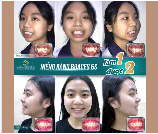 KHI NỤ CƯỜI THAY ĐỔI - SỰ TỰ TIN CŨNG TRỞ LẠI