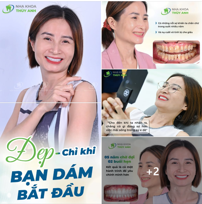 DẤU ẤN NACERA - VẺ ĐẸP TRONG TRẺO TỪ NỤ CƯỜI TỰ NHIÊN