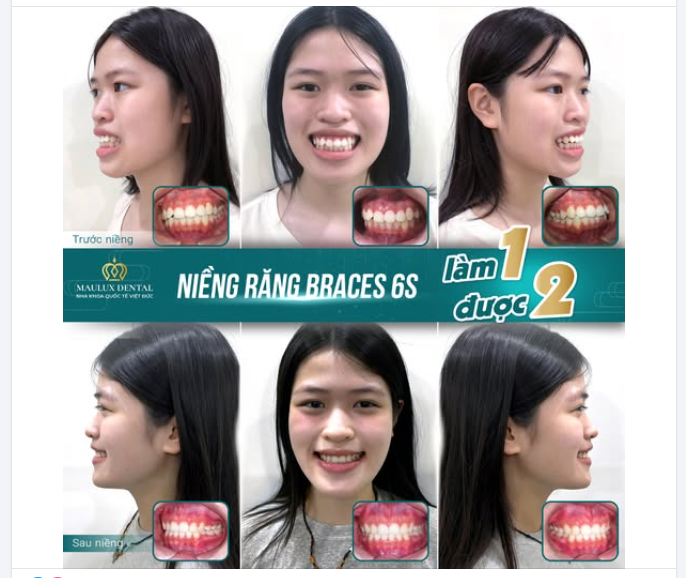 TỪ NỤ CƯỜI MẶC CẢM ĐẾN ÁNH NHÌN TỰ TIN - HÀNH TRÌNH CỦA HOÀNG LINH GIANG