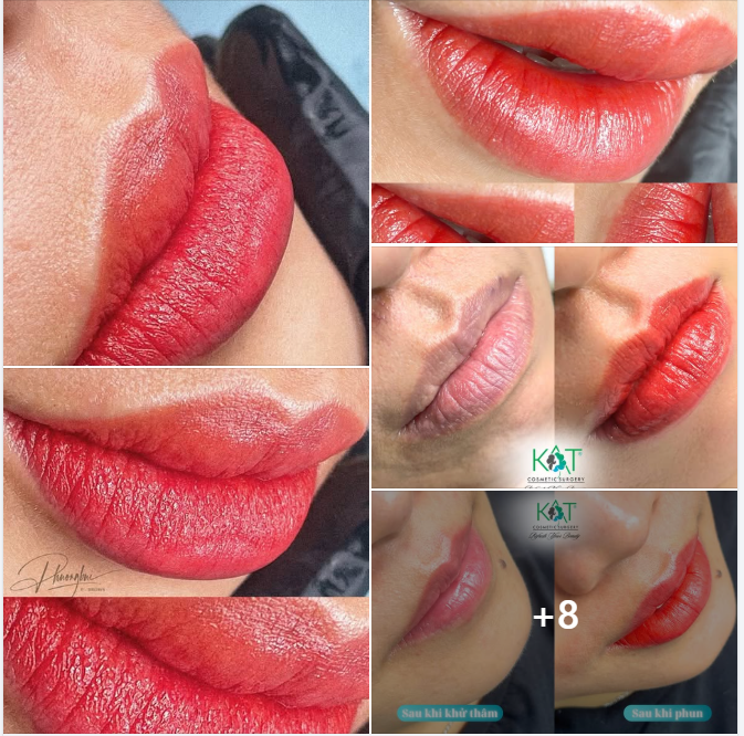 Từ sắc môi thâm xỉn đỏ siêu quyến rũ