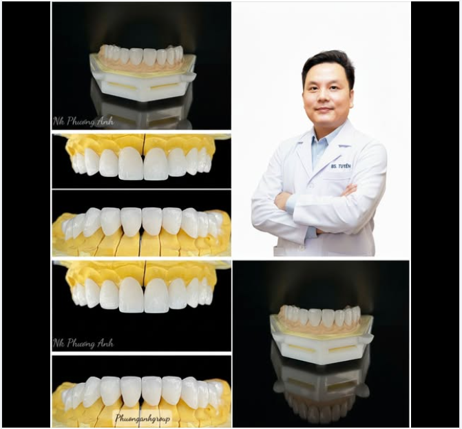 Răng sứ thẩm mỹ, thiết kế phù hợp