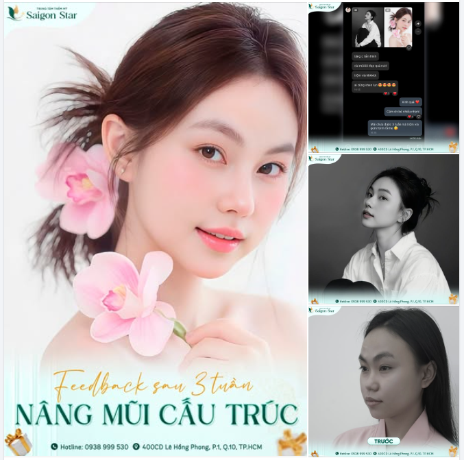 MŨI ĐẸP NHƯ NÀY… KHÔNG KHOE LÀ CÓ LỖI VỚI NHAN SẮC