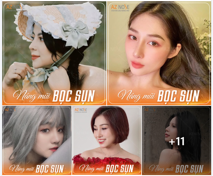 Nâng mũi bọc sụn - “nhẹ ví” nhưng vẫn đẹp bền lâu!