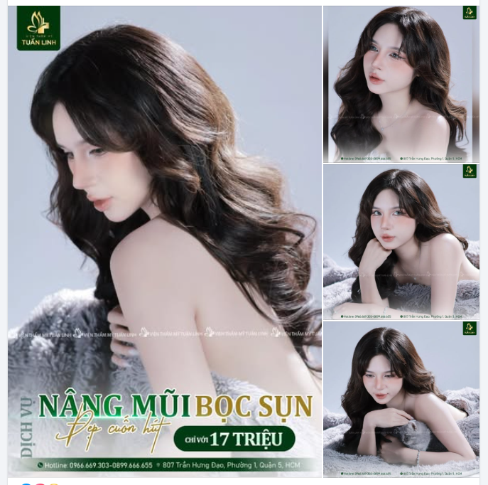 NÂNG MŨI BỌC SỤN - Phương pháp dành riêng cho những nền mũi "ít khuyết điểm".