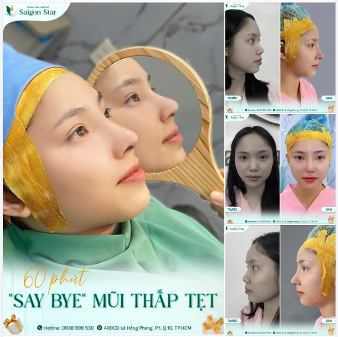 60 PHÚT "SAY BYE" MŨI THẤP TẸT – THAY ĐỔI DIỆN MẠO NGOẠN MỤC!
