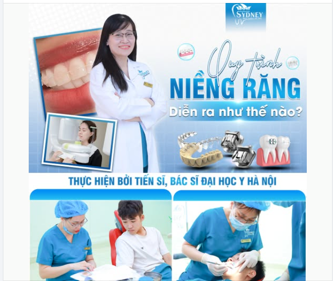 QUY TRÌNH NIỀNG RĂNG DIỄN RA NHƯ THẾ NÀO?