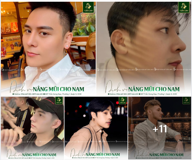NÂNG MŨI NAM - NÂNG TẦM TỰ TIN, BẢN LĨNH CHO NAM GIỚI.