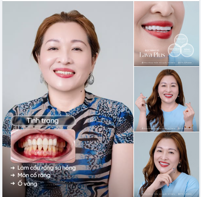 Không có món trang sức nào giúp người phụ nữ tỏa sáng hơn nụ cười tự tin của chính mình