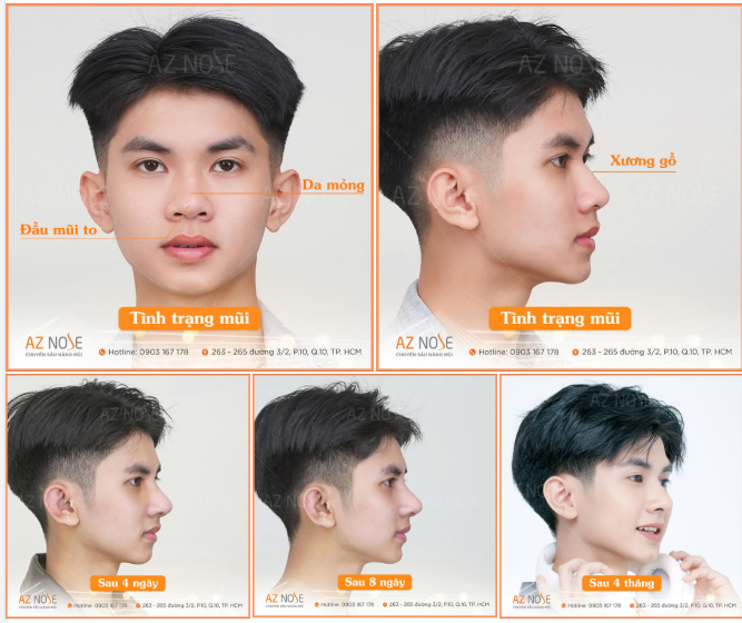 MC 2K3 nâng tầm phong thái sau 4 tháng thay đổi