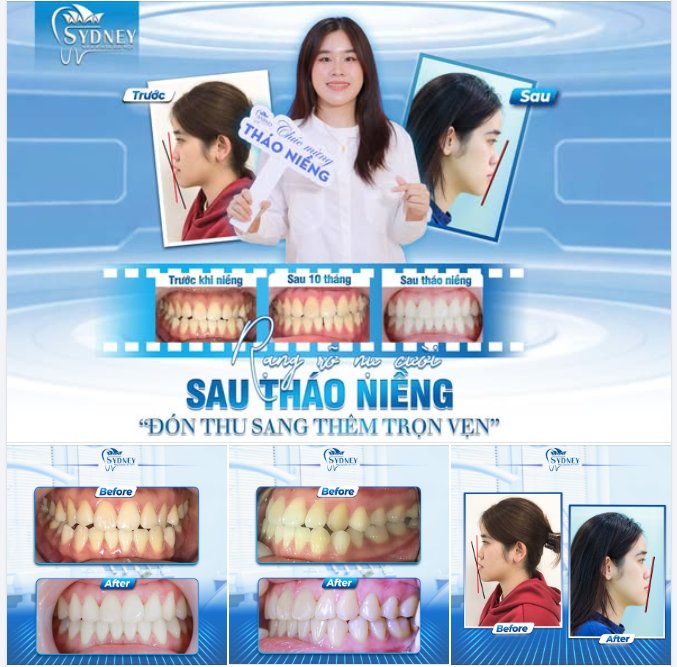 RẠNG RỠ NỤ CƯỜI SAU THÁO NIỀNG - ĐÓN THU SANG THÊM TRỌN VẸN