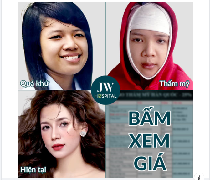 MÀN THAY ĐỔI GÂY SỐC: CÔ GÁI 9X CHI GẦN 500 TRIỆU THẨM MỸ KHIẾN AI CŨNG NGỠ NGÀNG