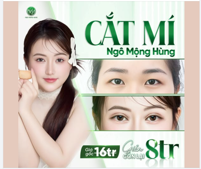 Tích tắc có ngay nếp mí xinh, đều đẹp, loại bỏ da chùng hiệu quả