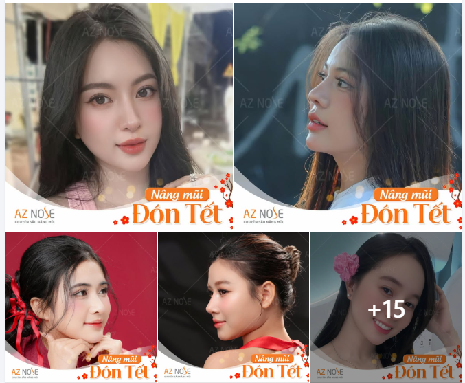 Tại sao đây là thời điểm tốt nhất để nâng mũi đón Tết?