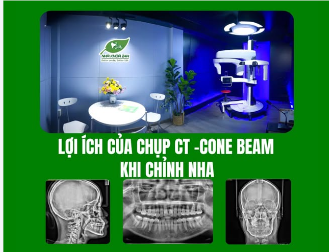 LỢI ÍCH CỦA CHỤP CT CONE-BEAM KHI CHỈNH NHA