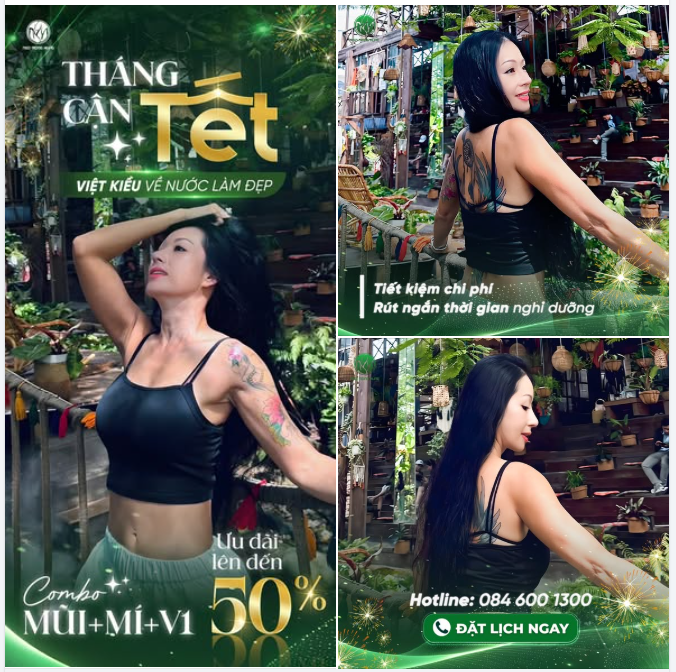 Khách hàng Việt Kiều đã “book” lịch làm đẹp chưa?  Combo mũi + mí + v1 - Ưu đãi lên đến 50%