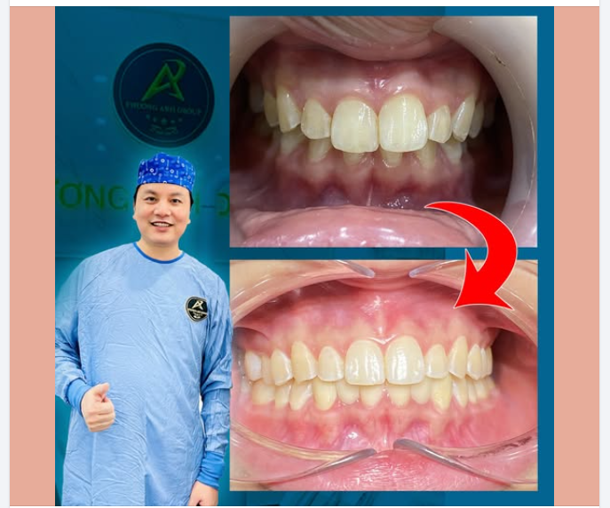 Chỉnh nha không chỉ là thẩm mỹ, mà là sức khỏe dài lâu.