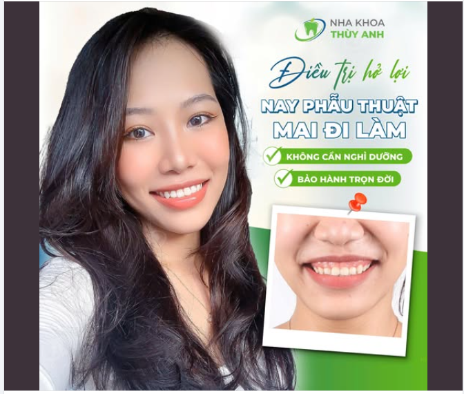 ĐƯỜNG TÌNH CÓ THỂ THUA NHƯNG ĐƯỜNG CƯỜI TỈ LỆ VÀNG ĐÓN TẾT EM CHẤP!