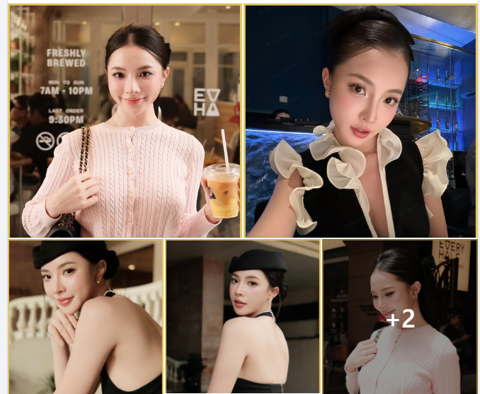 Từ nâng mũi bằng chỉ đến nâng mũi cấu trúc – bước ngoặt lớn trong hành trình hoàn thiện nhan sắc!