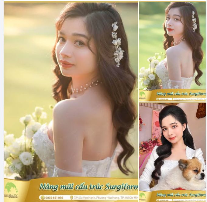 6 năm trước, cô gái 9X ấy đã quyết định thay đổi dáng mũi, một bước ngoặt nhỏ nhưng đủ để mở ra hành trình tự tin và yêu thương bản thân hơn.