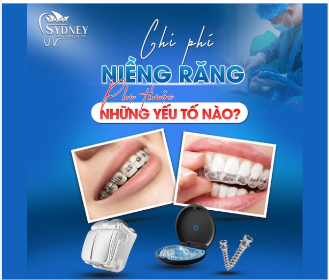CHI PHÍ NIỀNG RĂNG PHỤ THUỘC VÀO NHỮNG YẾU TỐ NÀO?