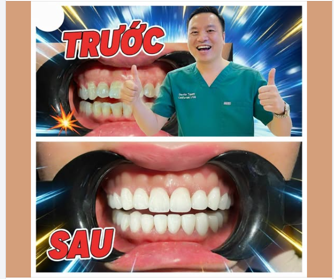 Nụ cười thay đổi – tự tin bứt phá!