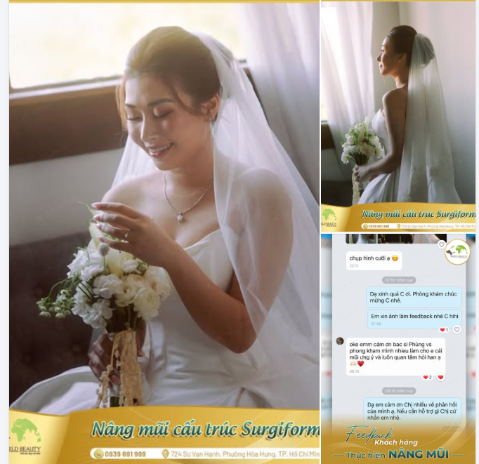 Lộ diện một nàng dâu xinh đẹp, rạng rỡ sau nâng mũi cấu trúc