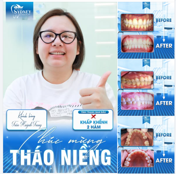 CHÚC MỪNG THÁO NIỀNG KH. HUỲNH TRANG