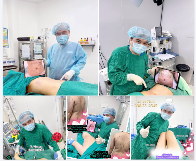 HÚT CẤY MỠ VỚI DR VƯƠNG: