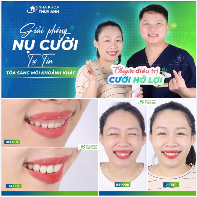 ''CƯỜI TƯƠI CỠ NÀO CŨNG CHẲNG CÒN E NGẠI NỮA!''
