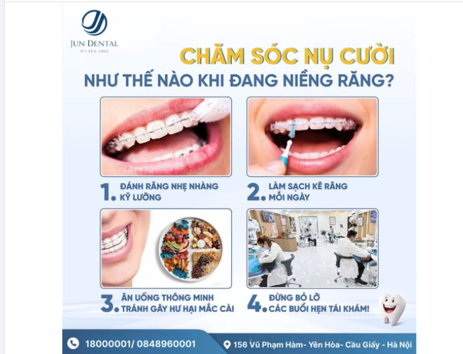 Giữ nụ cười luôn khỏe – Bí quyết vàng cho người đang niềng răng