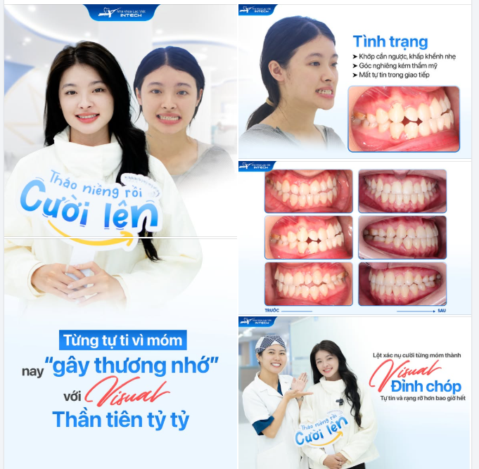 "VÂN ANH ƠI! CÓ LÀM GÌ KHÁC NGOÀI NIỀNG RĂNG KHÔNG MÀ XINH THẾ!!"